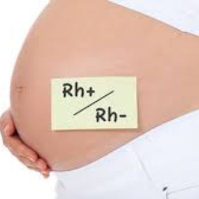 Fator RH negativo